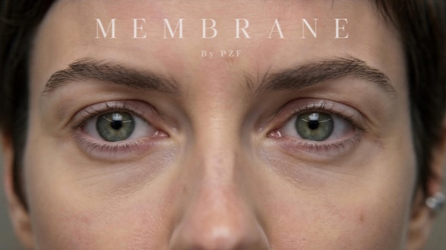 Membrane